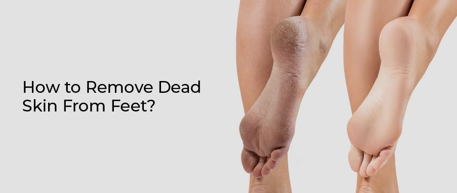 How to remove dead skin from feet